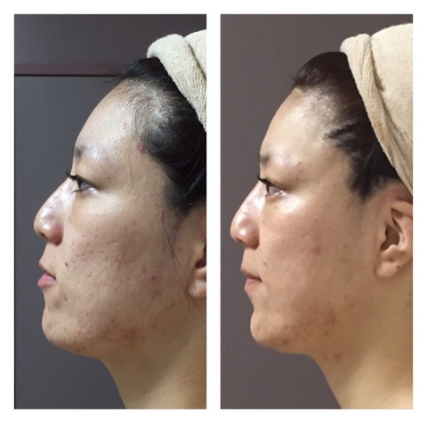 {7F69F16D-B3C4-495D-8321-96940FD61671}