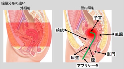 {4DC75B3B-491A-494D-AD3C-E4B64E3993E8}